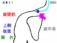 頸肩腕症候群の鍼灸治療で使用する「肩井(けんせい)」というツボの図解