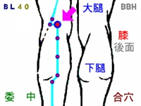 脊柱管狭窄症の鍼灸（はりきゅう）治療で使用する委中（いちゅう）というツボの図解