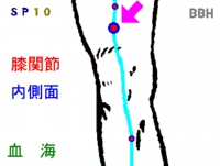 変形性膝関節症に効果のあるツボ「血海」の場所の図解