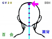 片頭痛の鍼灸（はりきゅう）治療で使う百会（ひゃくえ）というツボの図解