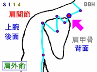 緊張性頭痛の鍼灸治療で使用する肩外兪(けんがいゆ)というツボの図解
