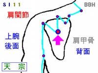 五十肩の鍼灸(はりきゅう)治療で使う天宗(てんそう)というツボの図解