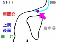 鞭打ち症の鍼灸（はりきゅう）治療で使用する肩井（けんせい）というツボの図解